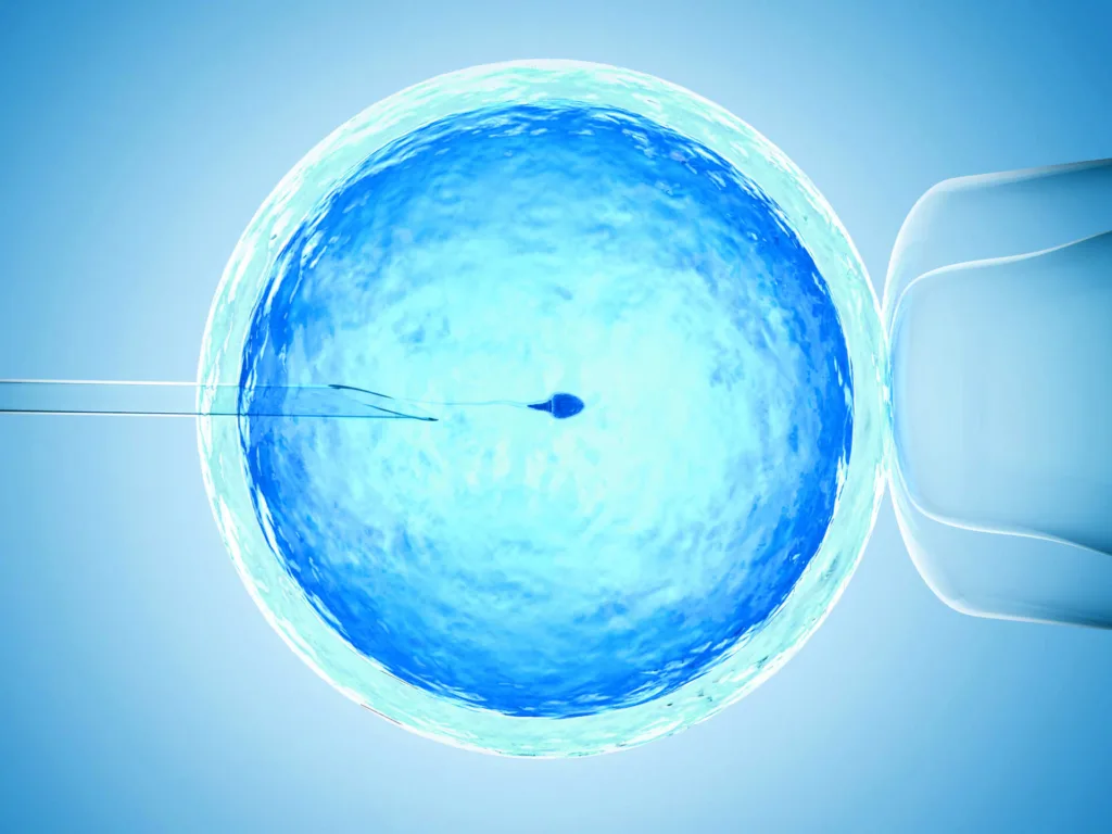 artificial insemination or ivf